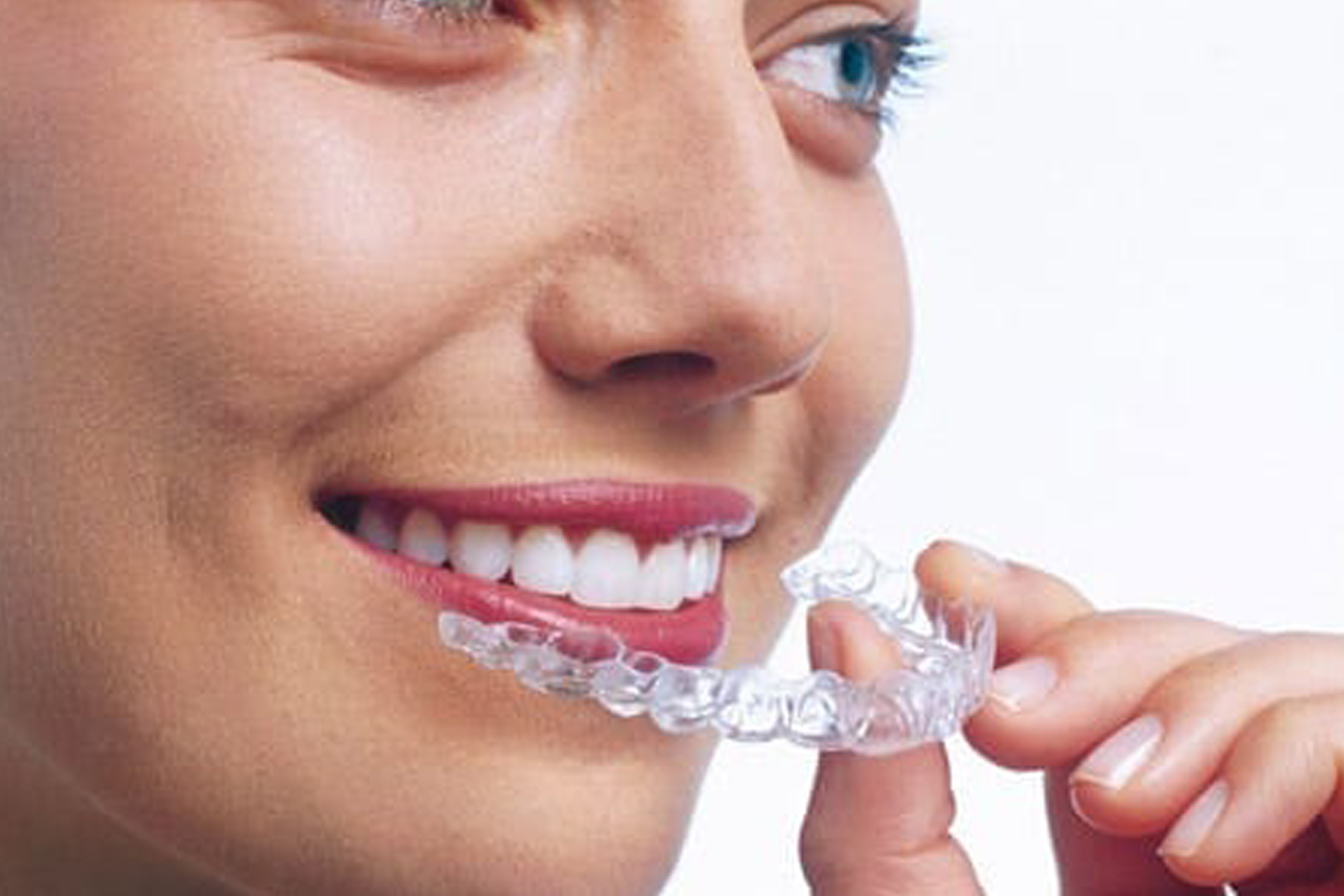 Aesthetika Dental Studio Braces for Adults