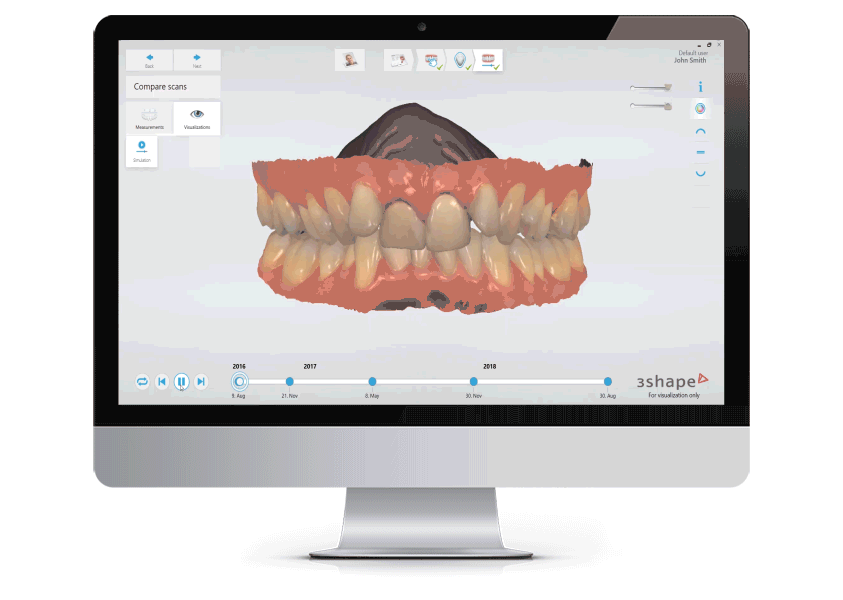 Aesthetika Dental Studio Invisalign