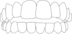 Aesthetika Dental Studio Invisalign