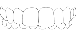 Aesthetika Dental Studio Invisalign