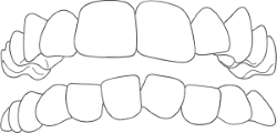 Aesthetika Dental Studio Invisalign