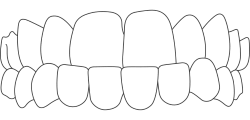 Aesthetika Dental Studio Invisalign