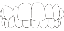 Aesthetika Dental Studio Invisalign