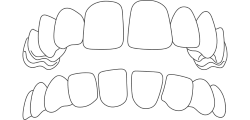 Aesthetika Dental Studio Invisalign