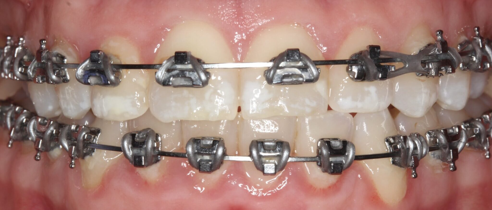 Aesthetika Dental Studio Fastbraces