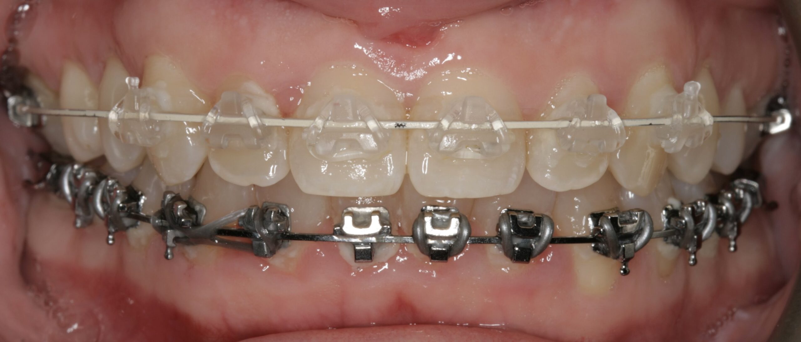 Aesthetika Dental Studio Fastbraces