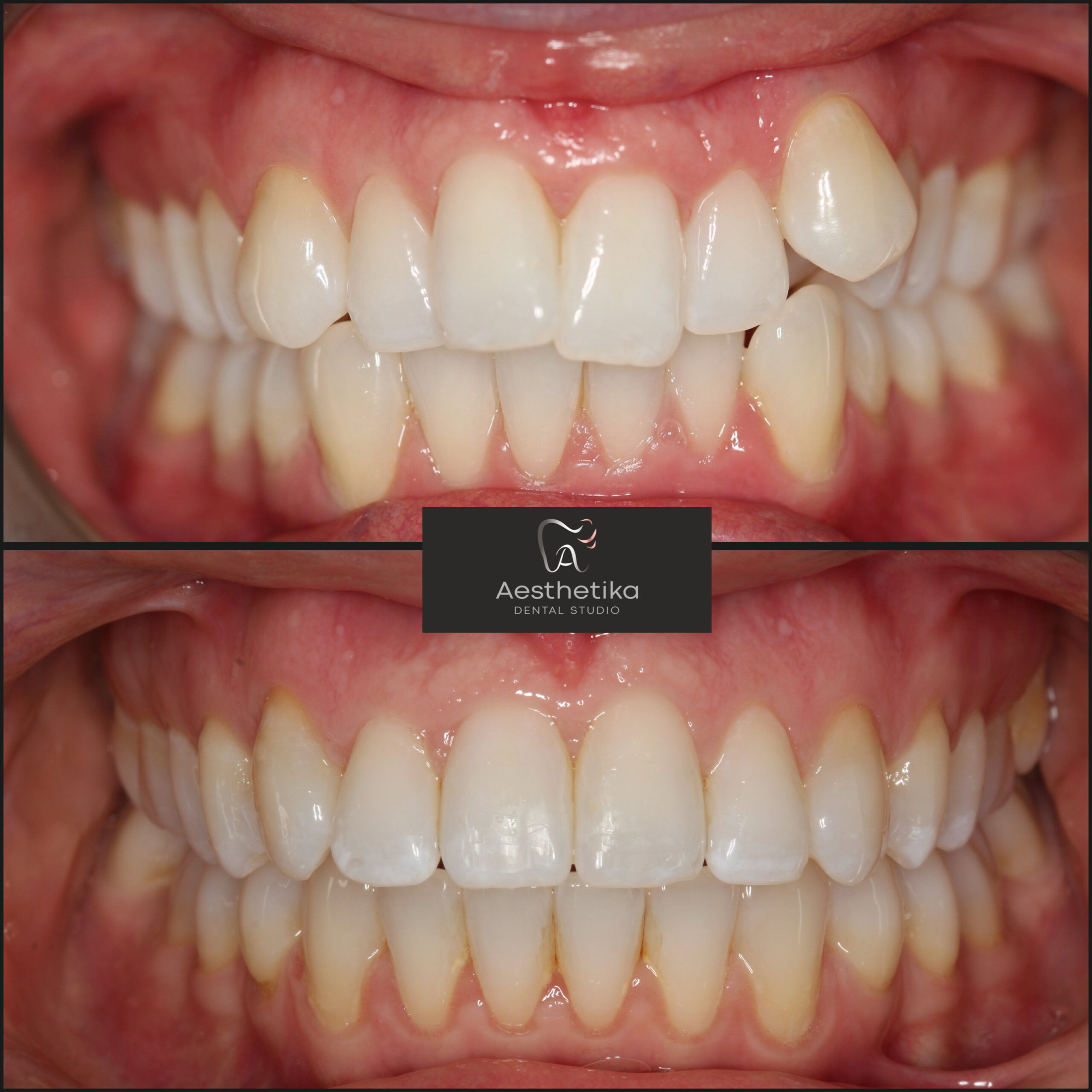 Aesthetika Dental Studio before and after