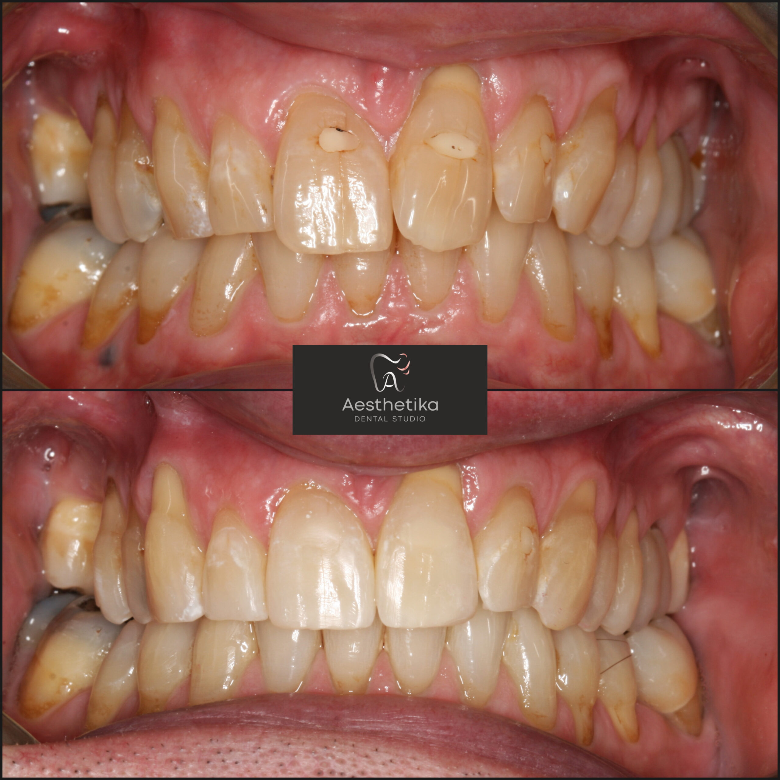 Aesthetika Dental Studio before and after